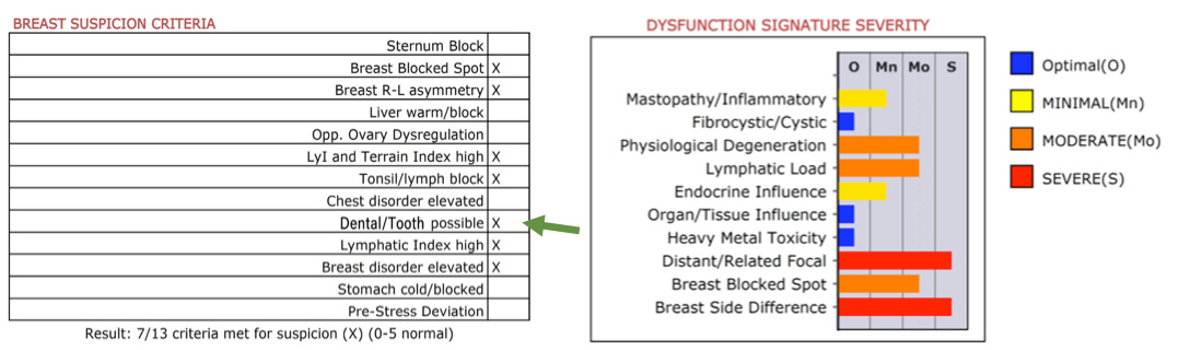 breast suspicion dys severrity