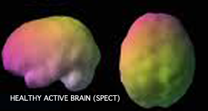 spectbrain2